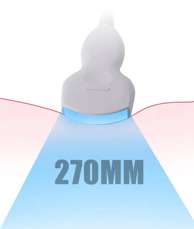 Ultrasound Scanner View 2