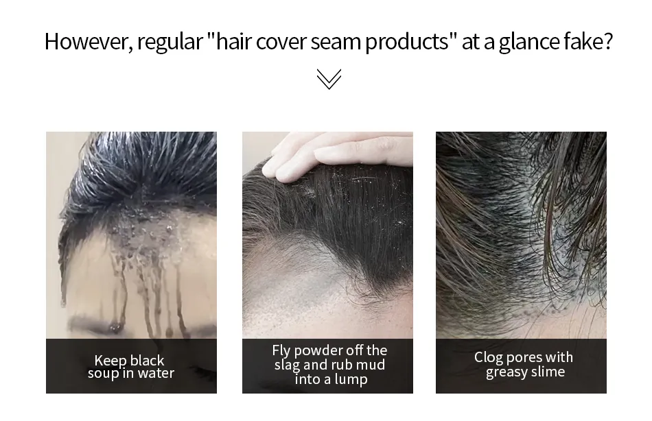 Bald Scalp Coverage