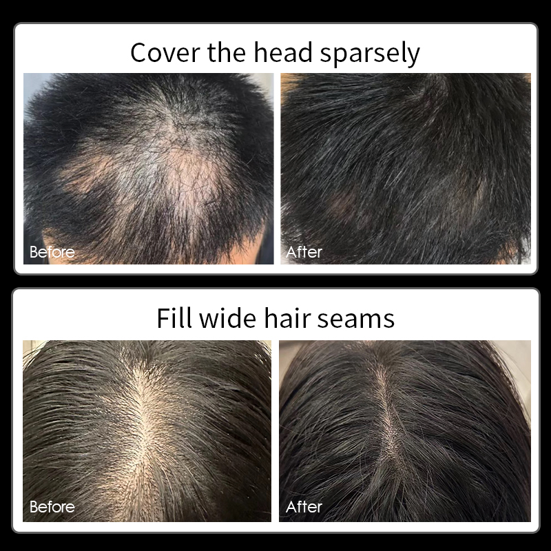 New Organic Grey Concealer Gel Spray for Thinning Hair Beards Natural Long Lasting Bald Scalp Coverage Herbal Factory Fresh