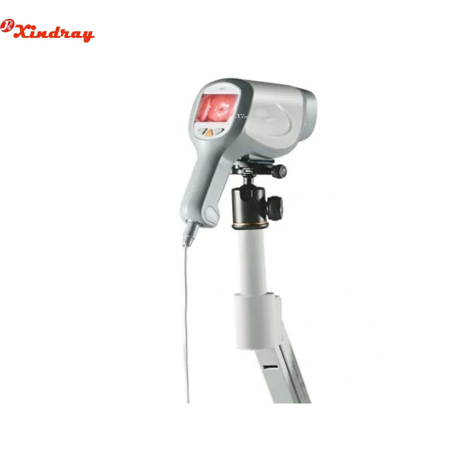 Digital Imaging System Video Colposcope