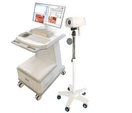 Self-Produced HD Video Colposcope Hot Sale Vaginal Camera for Vagina