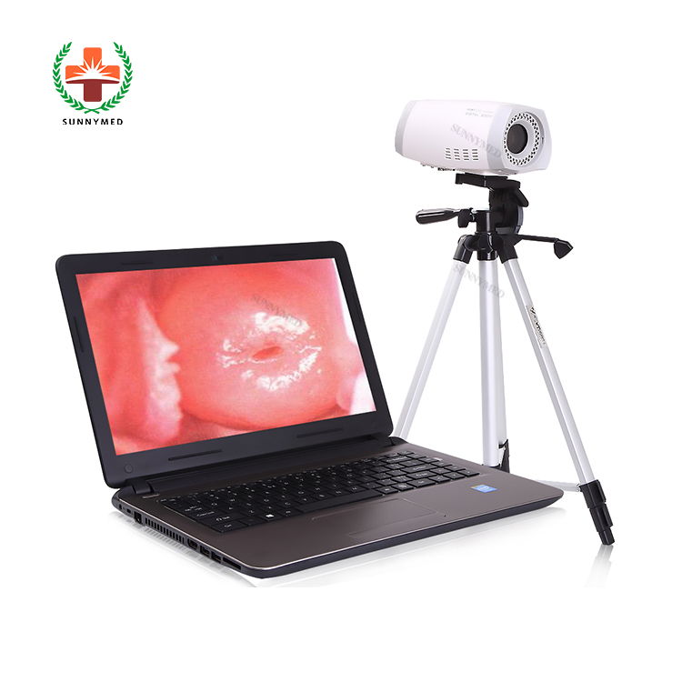 Sy-F003 Colposcope Digital Imaging System Gynecology Colposcope