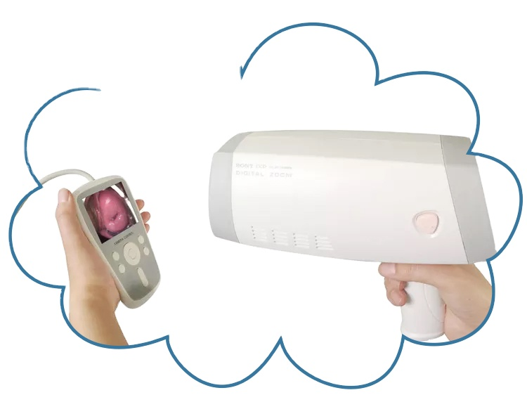 Self-Produced HD Video Colposcope Hot Sale Vaginal Camera for Vagina