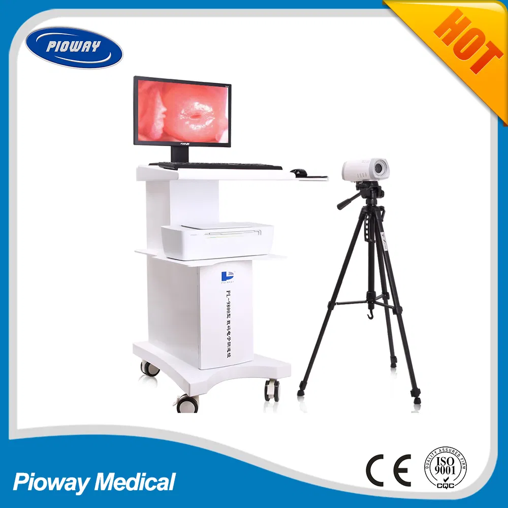 Medical Equipment Colposcope for Gynecology Pl-9800t