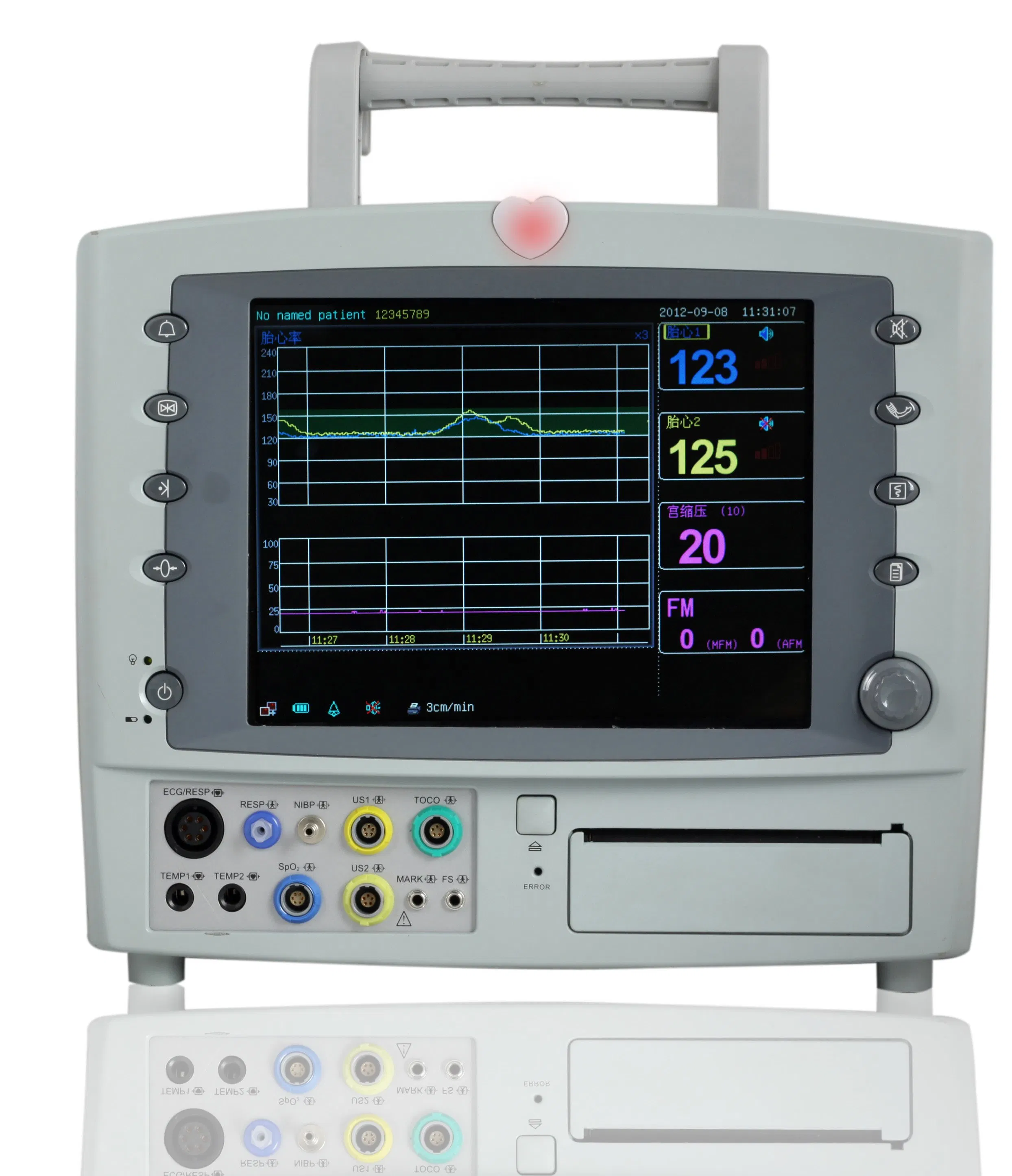 Portable Fetal Monitor, Fetal Doppler