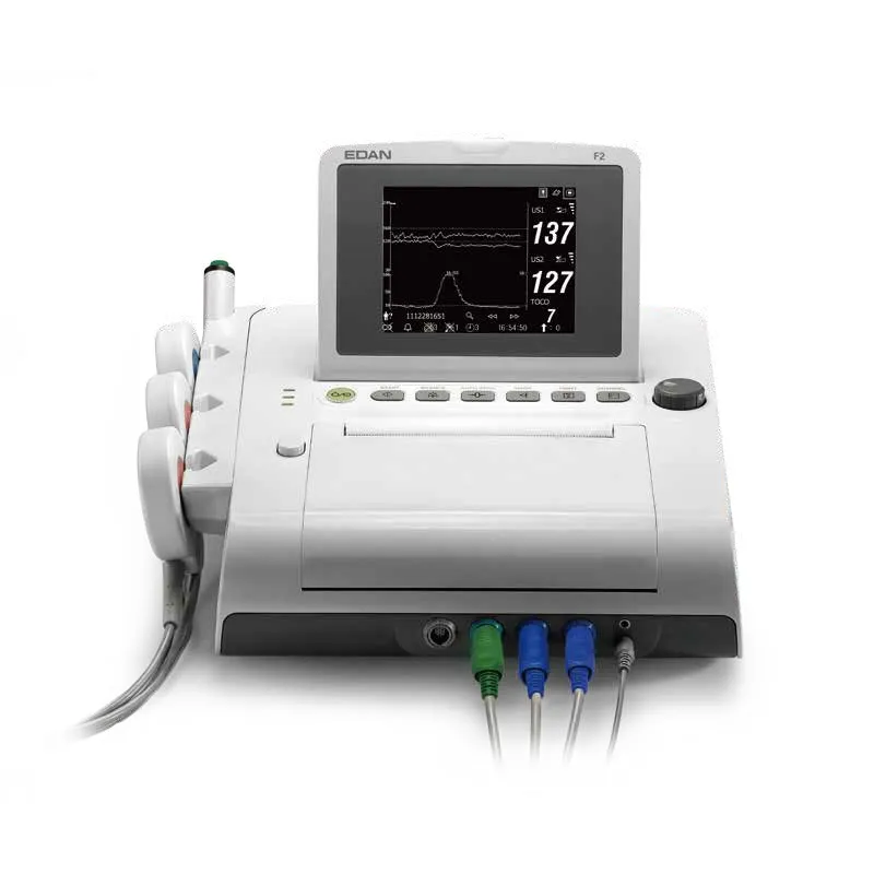 Fetal Monitor View 5