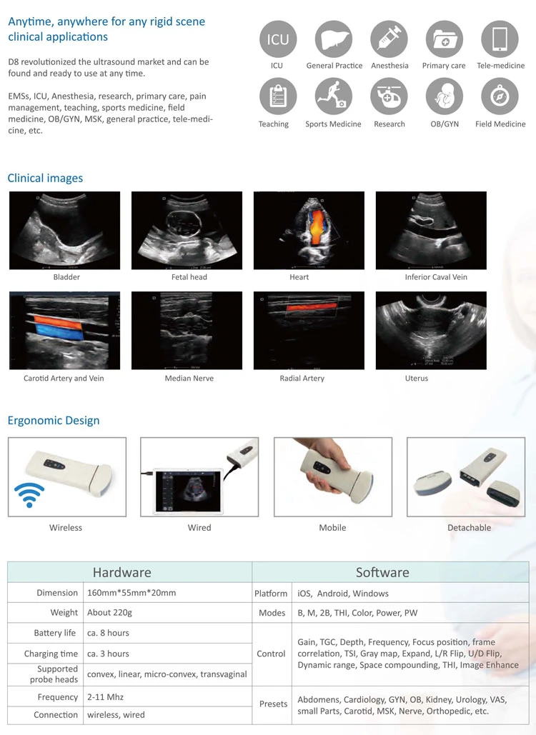 My-A010L China Manufacturing Mini Pocket Wireless WiFi Probe Ultrasound Handheld Device