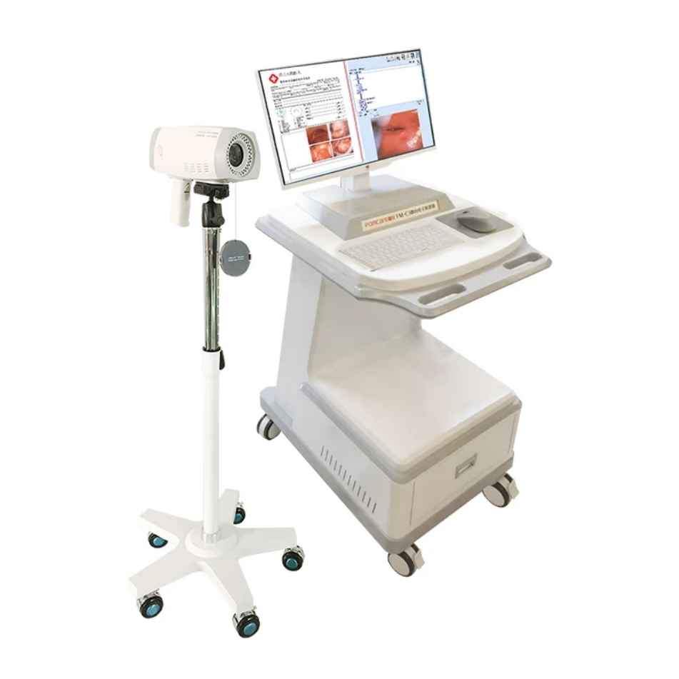 High Level Digital Gynecology Video Colposcope Imaging System