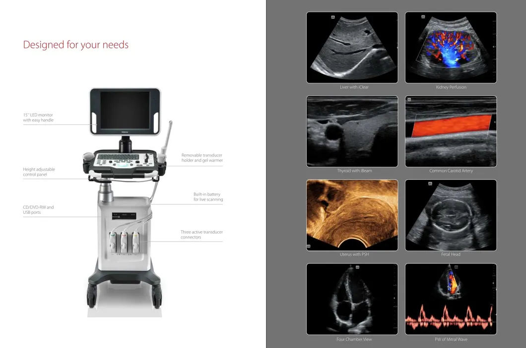 Mindray DC30 Imaging System 4