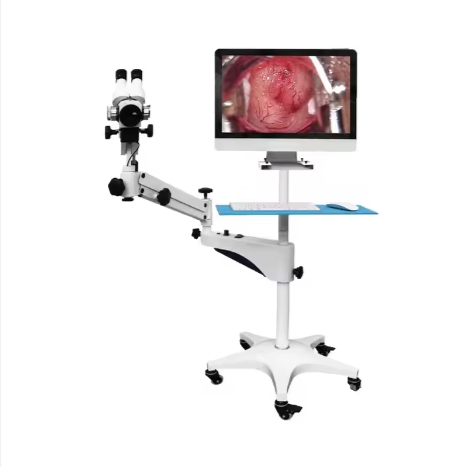 Medical Colposcope Portable Optical Colposcope Digital Colposcope for Gynecology