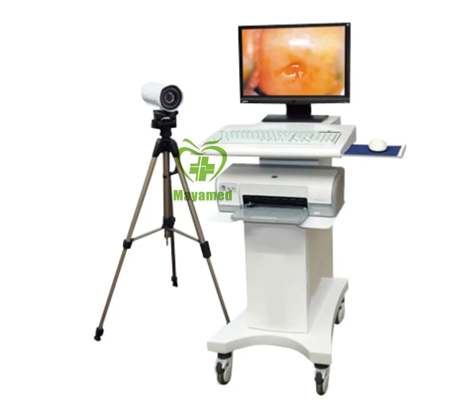 Electronic Handheld Digital Video Colposcope MY-F004