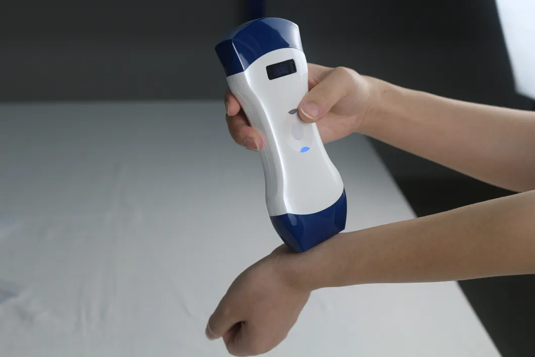 Ultrasound Handheld Device 2