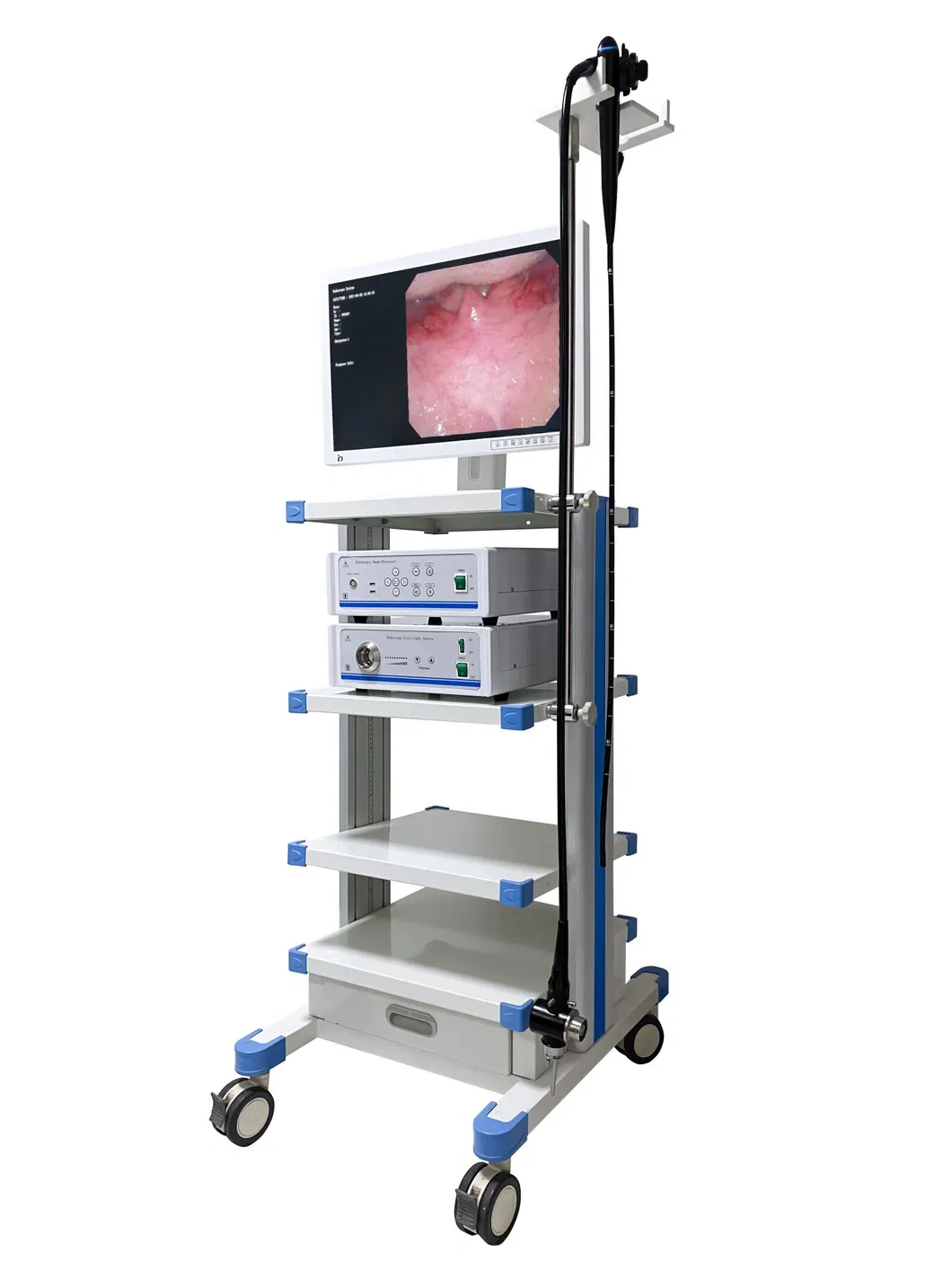 Video Endoscopy System