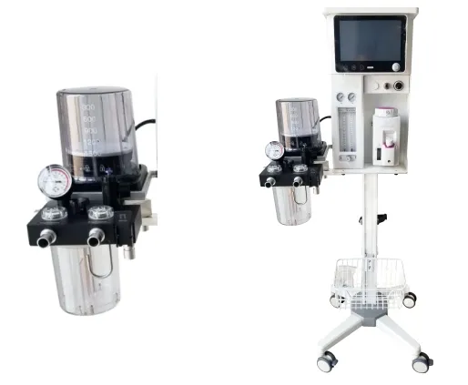 Ventilator Display Details