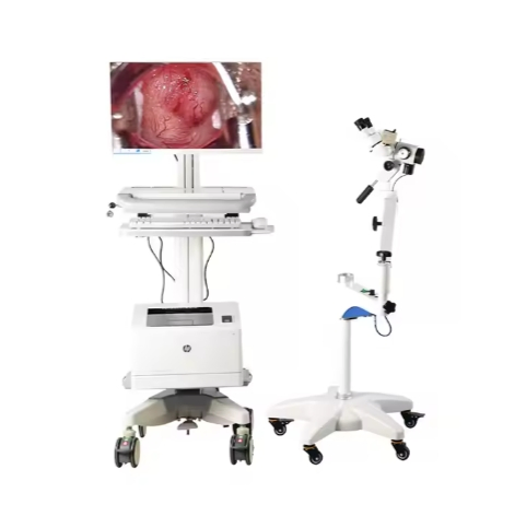 Medical Colposcope Portable Optical Colposcope Digital Colposcope for Gynecology