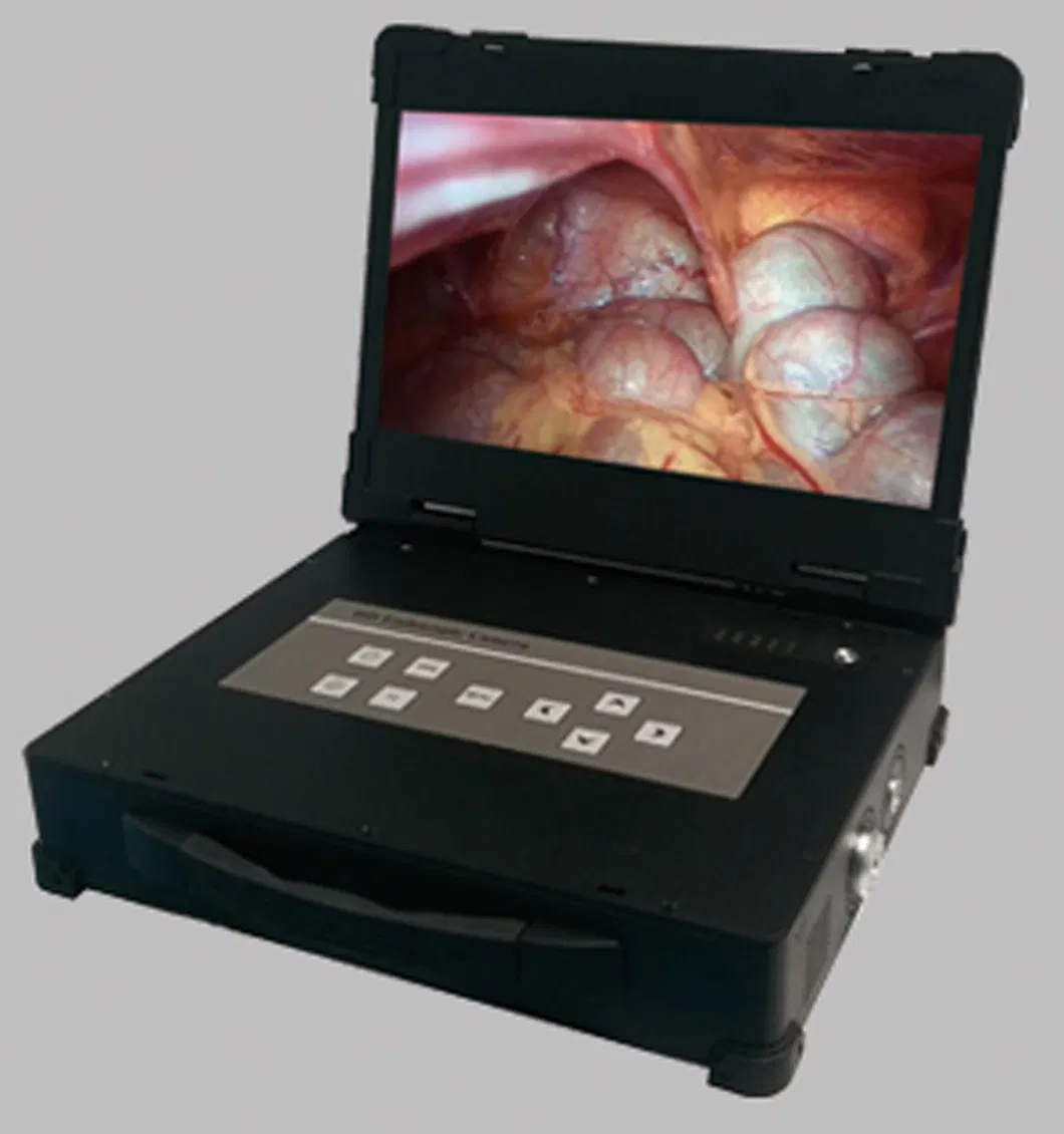 Medical Integrated Endoscopy Camera System