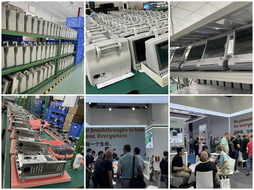 Ctg Machine Maternal Fetal Monitor Main View
