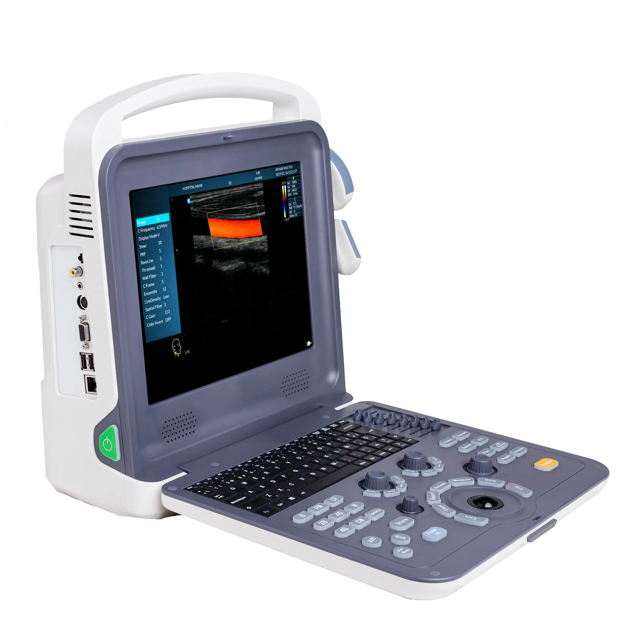 Umy Umus094 Advanced Color Doppler Ultrasonic Diagnostic Imaging System for Professionals