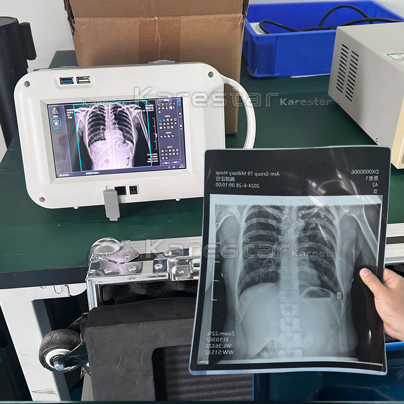 K-Dx70 Portable Medical X Ray Digital Machine for Human Use Cheapest Hospital Clinic X Ray Machine Price