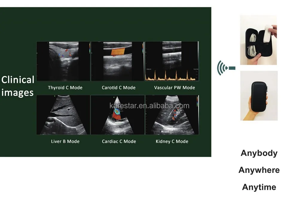 Ultrasound Display 2
