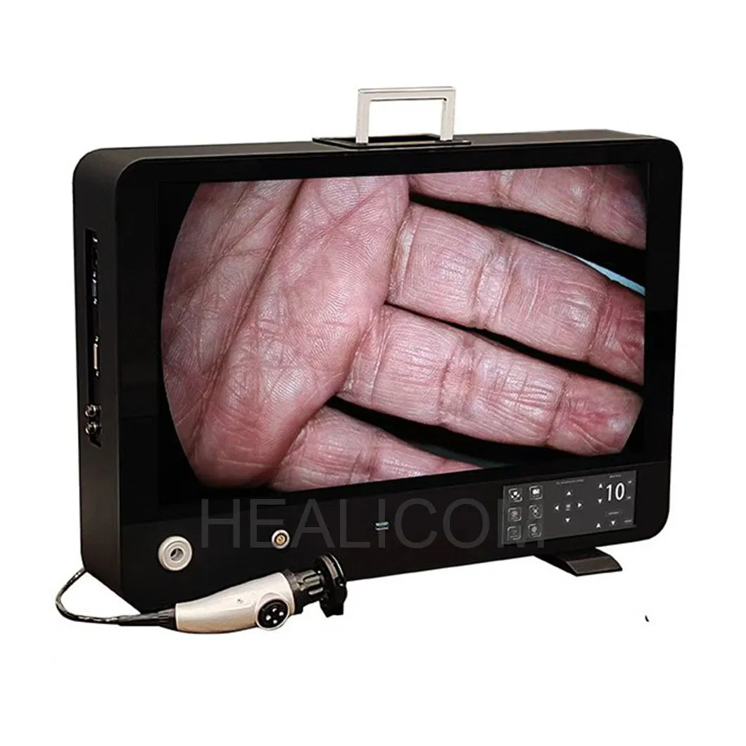 Integrated Endoscopy Camera System