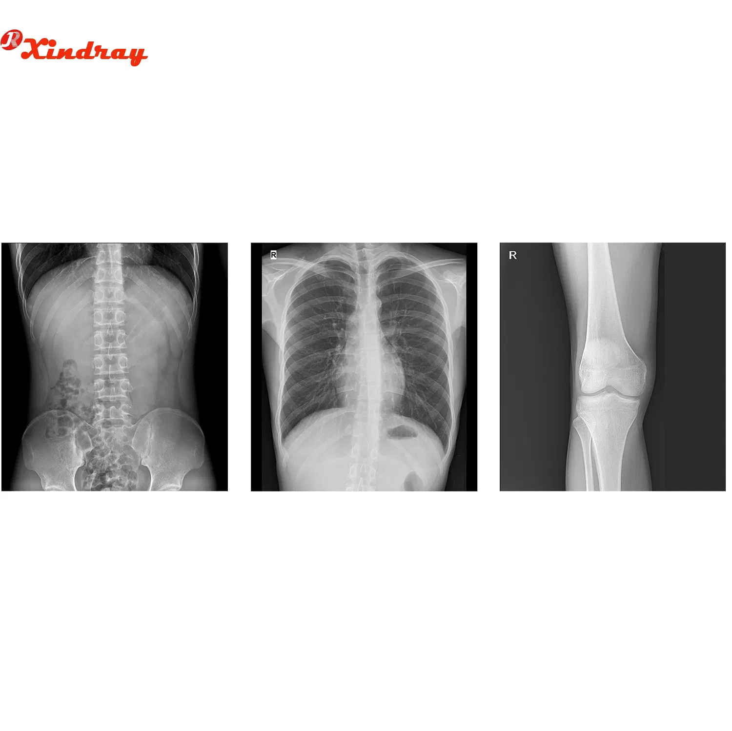 User-Friendly Touch Screen Digital Imaging Mobile X-ray Machine