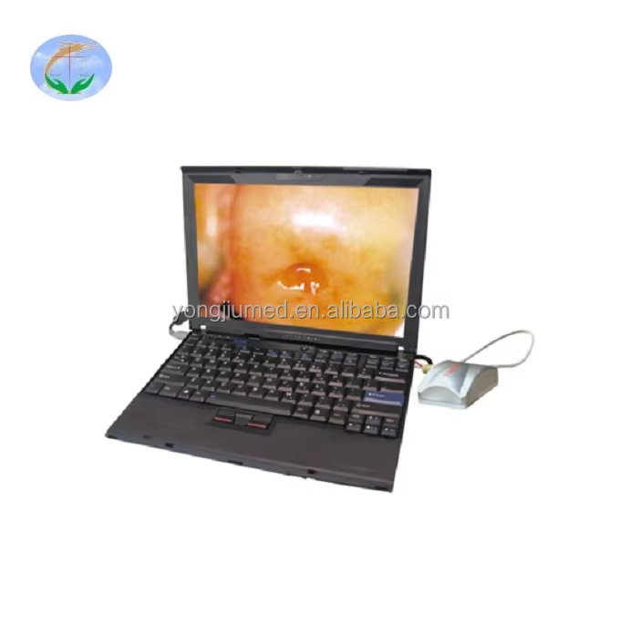 Portable Vagina Video Colposcope Notebook Digital Electronic Colposcope for Gynecology Colposcope Camera Machine