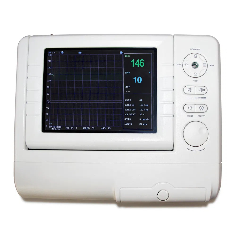Fetal Monitor View 2