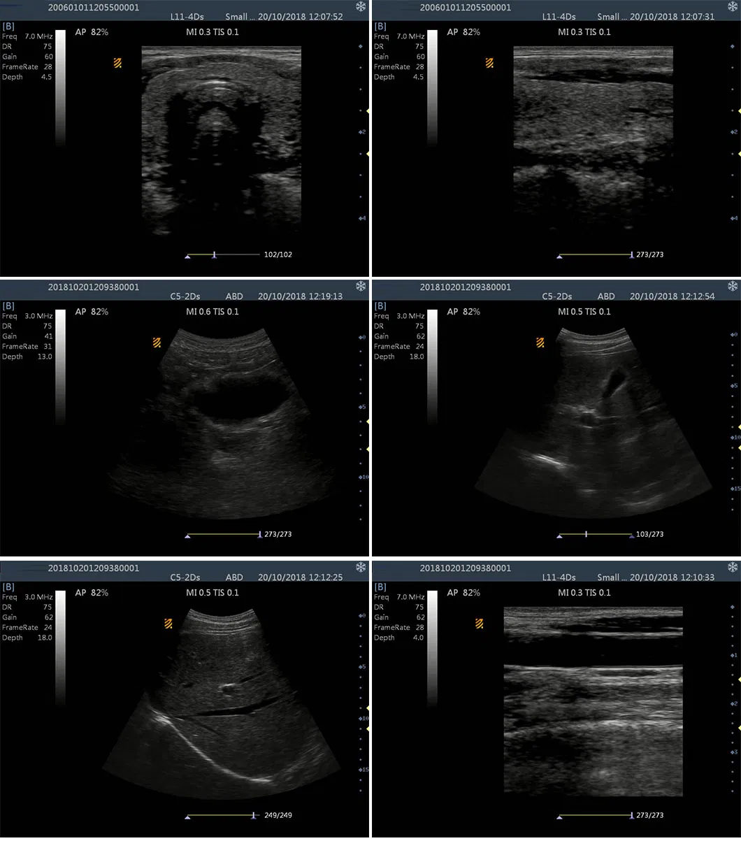 Clinical Ultrasound Image