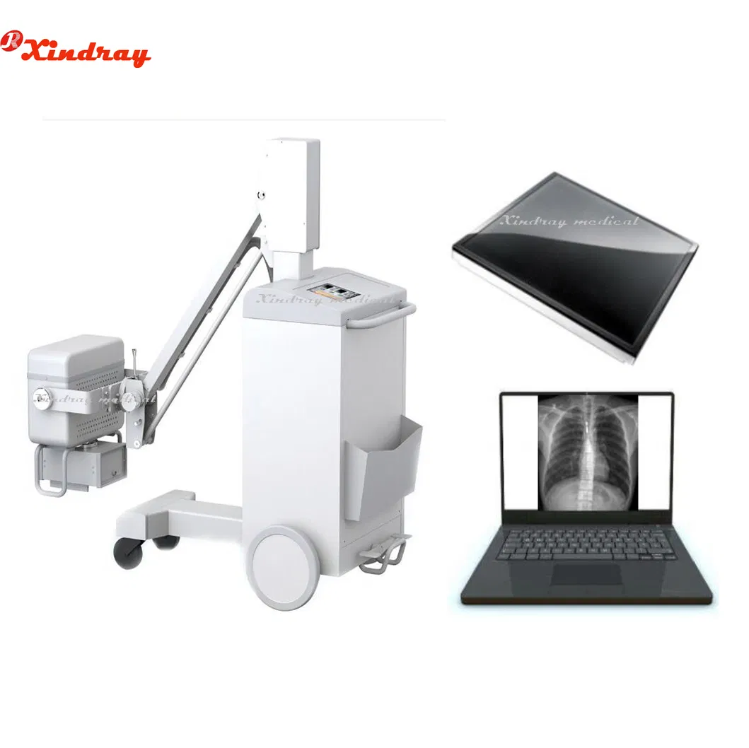 Touch Screen Digital Imaging Mobile X-ray Machine