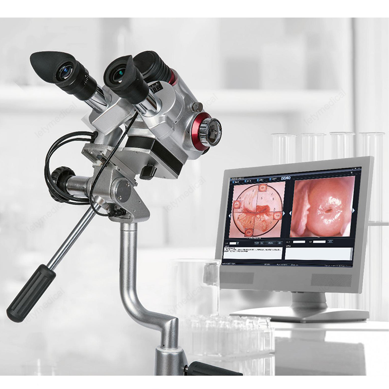 Colposcope Colposcopy Colposcope HD Digital Video Colposcope for Gynecology Colposcopy