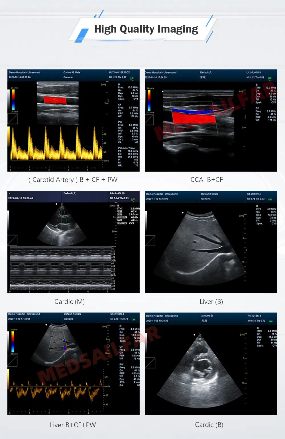 Ultrasound Equipment 3