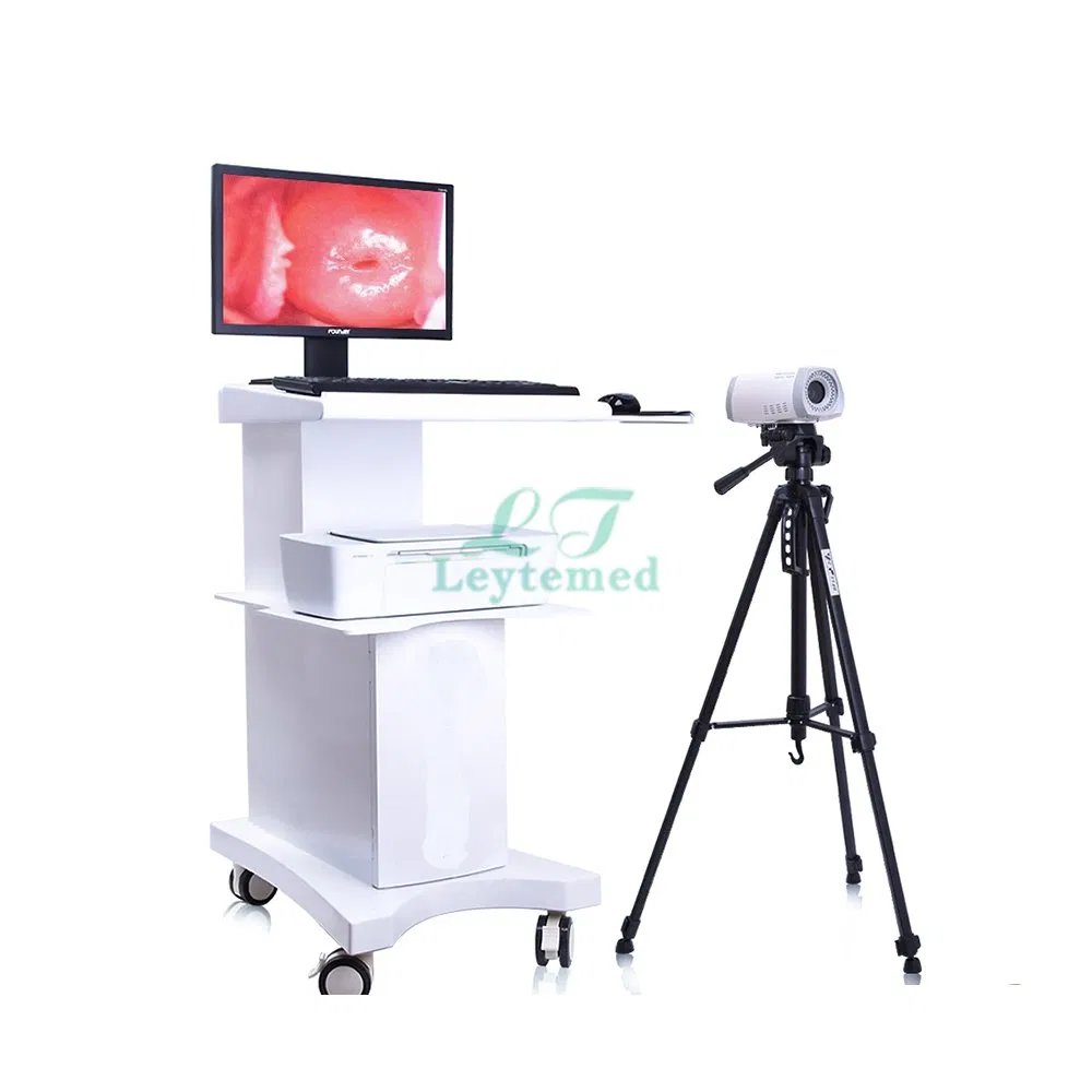 Ltec03 Trolley Video Colposcope