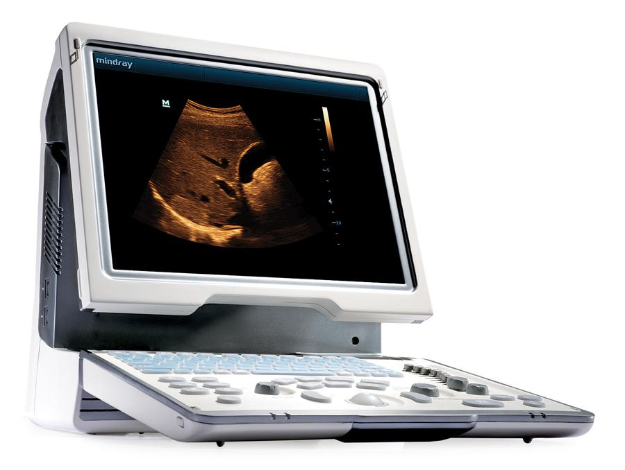 Medical Apparatus Digital Ultrasonic Diagnostic Imaging System