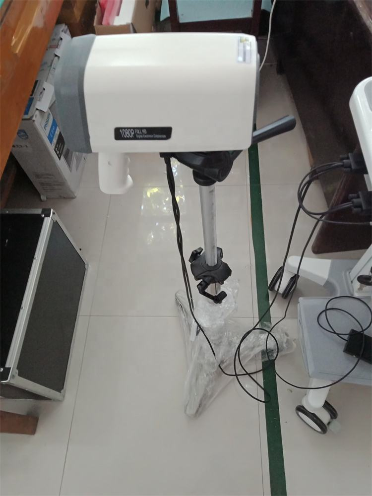 Ouman Full HD Portable Video Colposcope Vaginal Colposcopy Medical Device