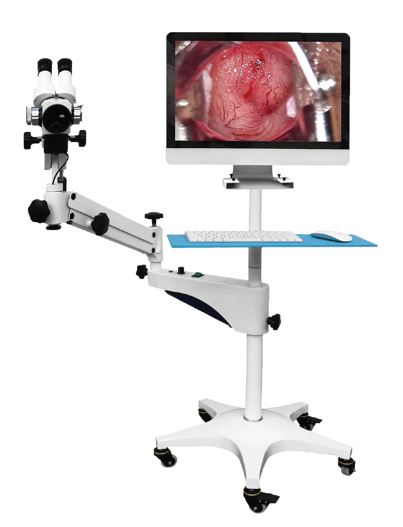 Video Colposcope HD Digital Video Colposcope System for Gynecology