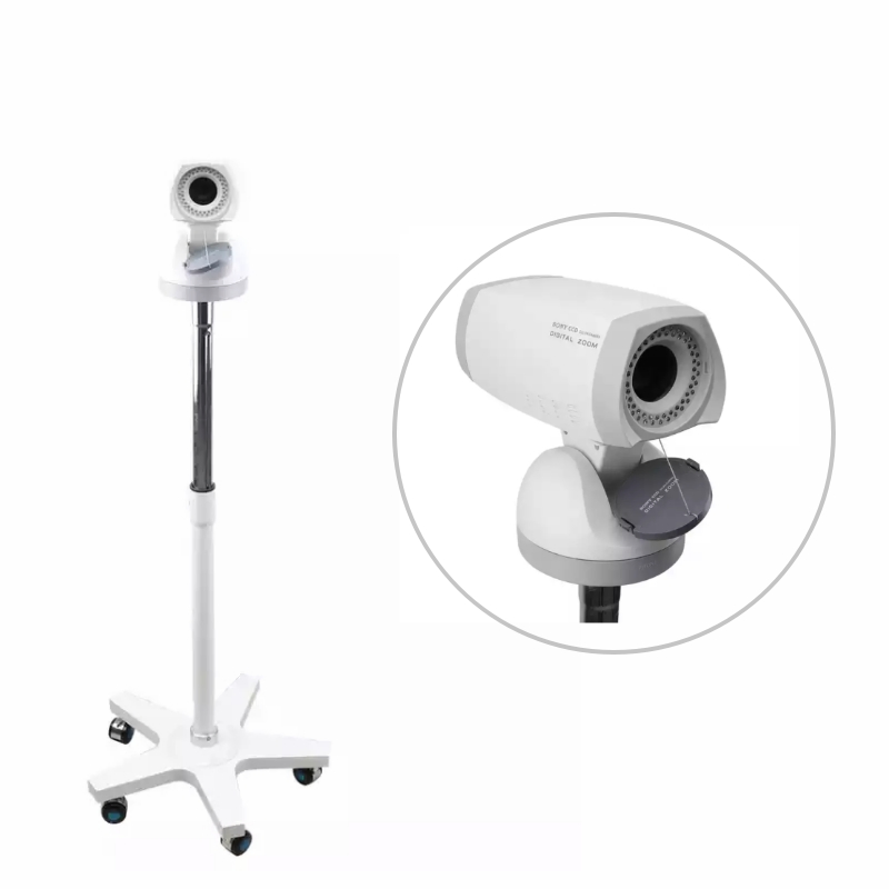 Hot Sale Medical Portable Camera Endoscope Digital Video Colposcope for Vagina