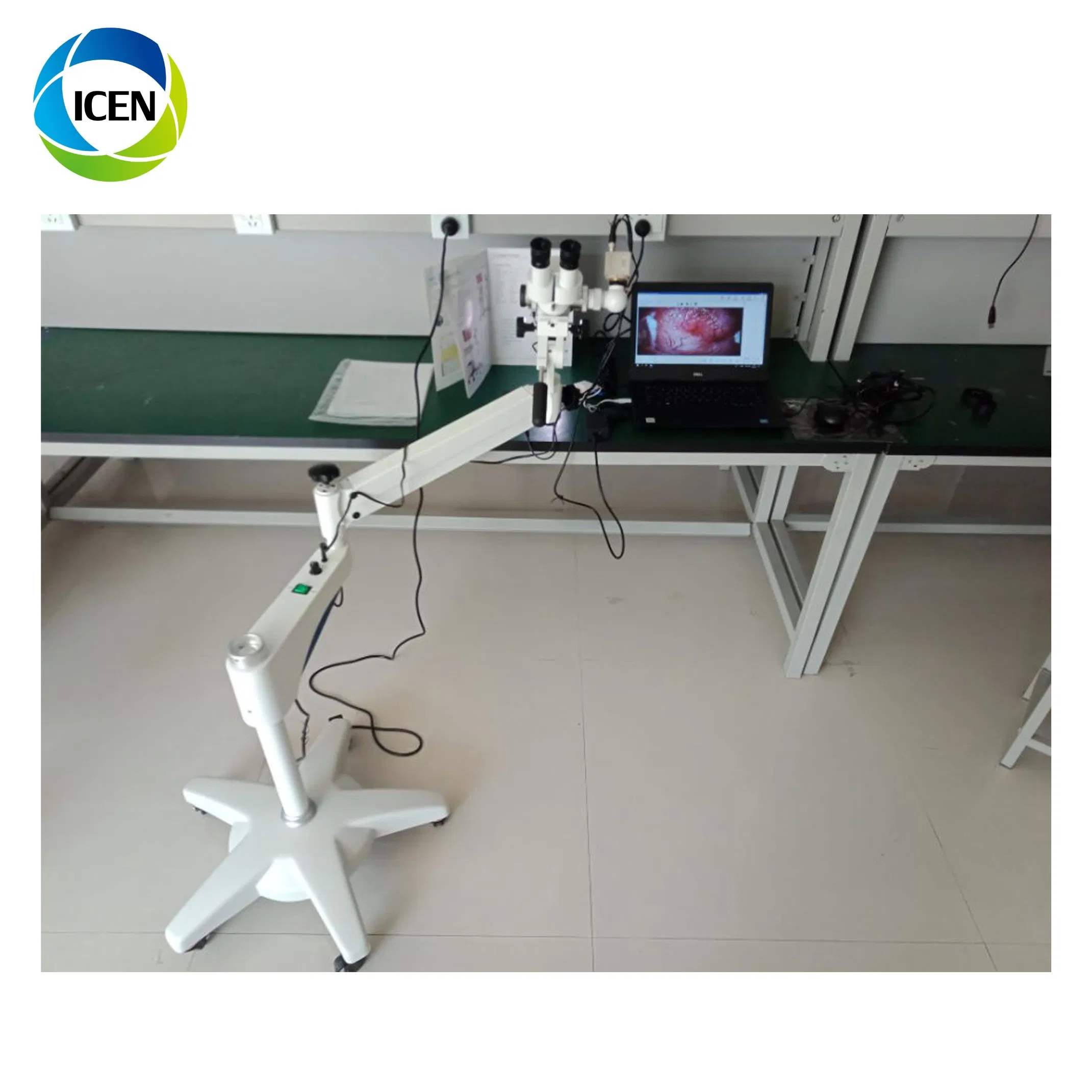 in-B9200 Portable Endoscope Digital Optical Gynecology Colposcope Price