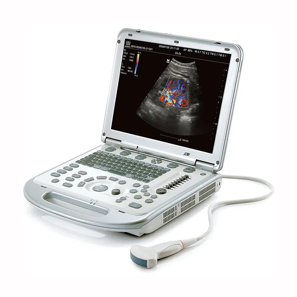 Mindray M7 Premium Hand Carried Ultrasonic Diagnostic Imaging System Color Doppler Ultrasound System