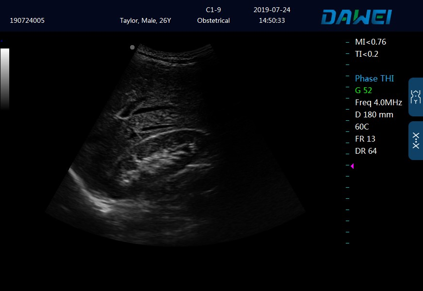 Laptop Ultrasound Device for Hospital 2023 New Arrival