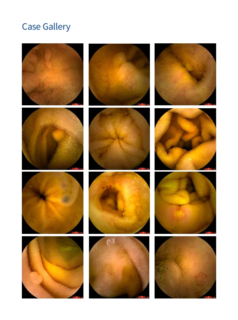 Professional Capsule Endoscopy