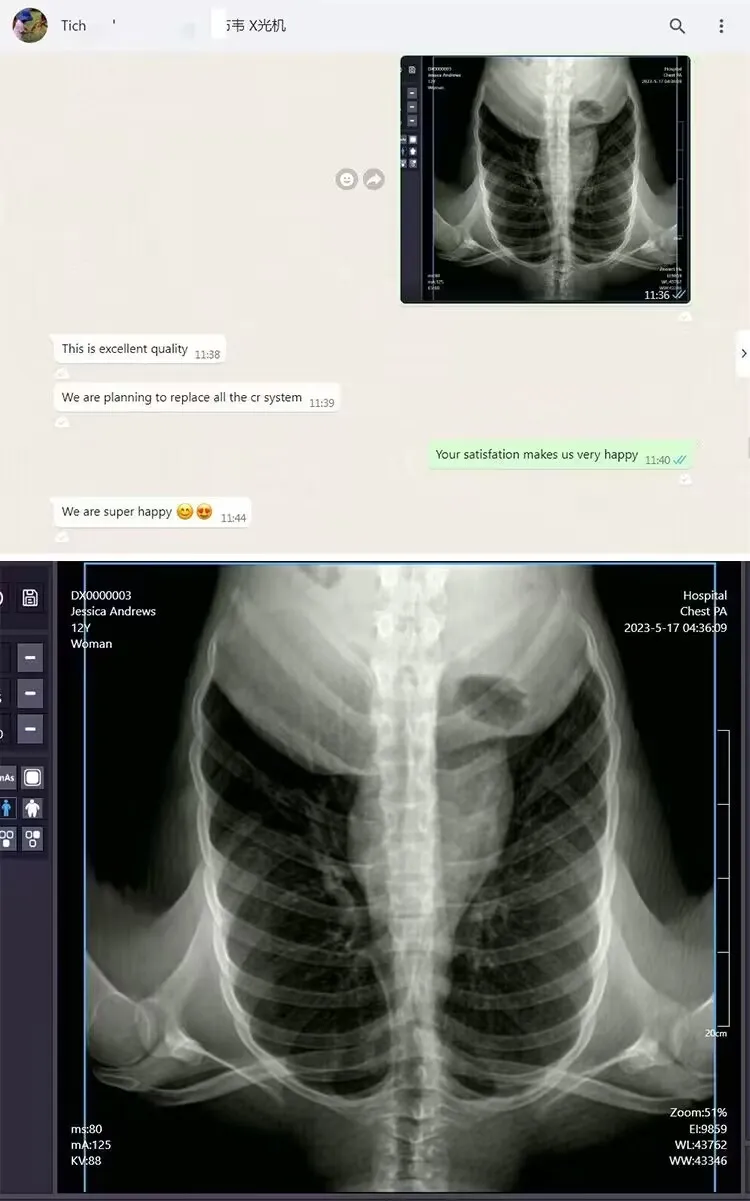 Digital Radiography Detail