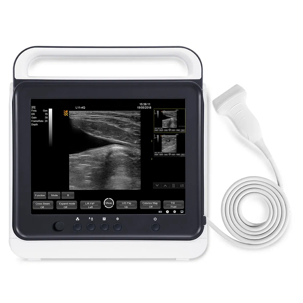 Hospital Clinic Touch Screen B/W Portable Ultrasound Devices
