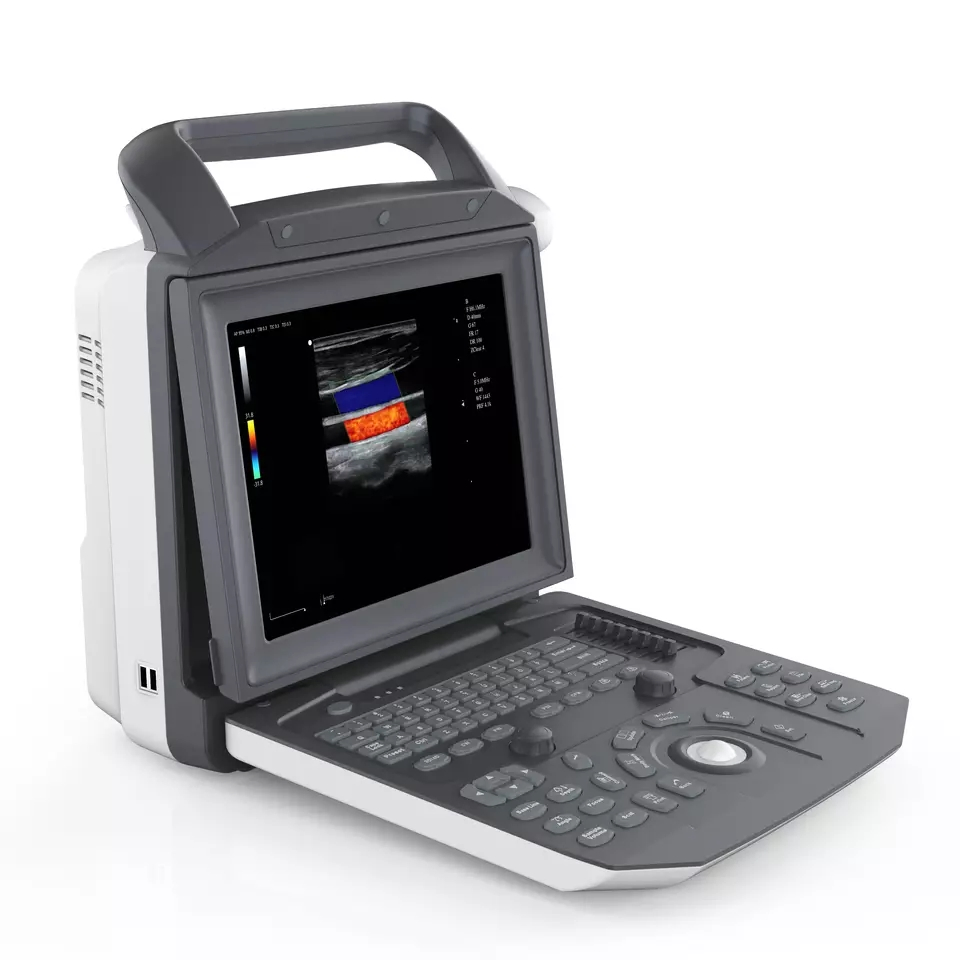 Obstetrics Gynecology Cardiac Portable Ultrasound Machine Full Digital Ultrasonic Diagnostic Imaging System