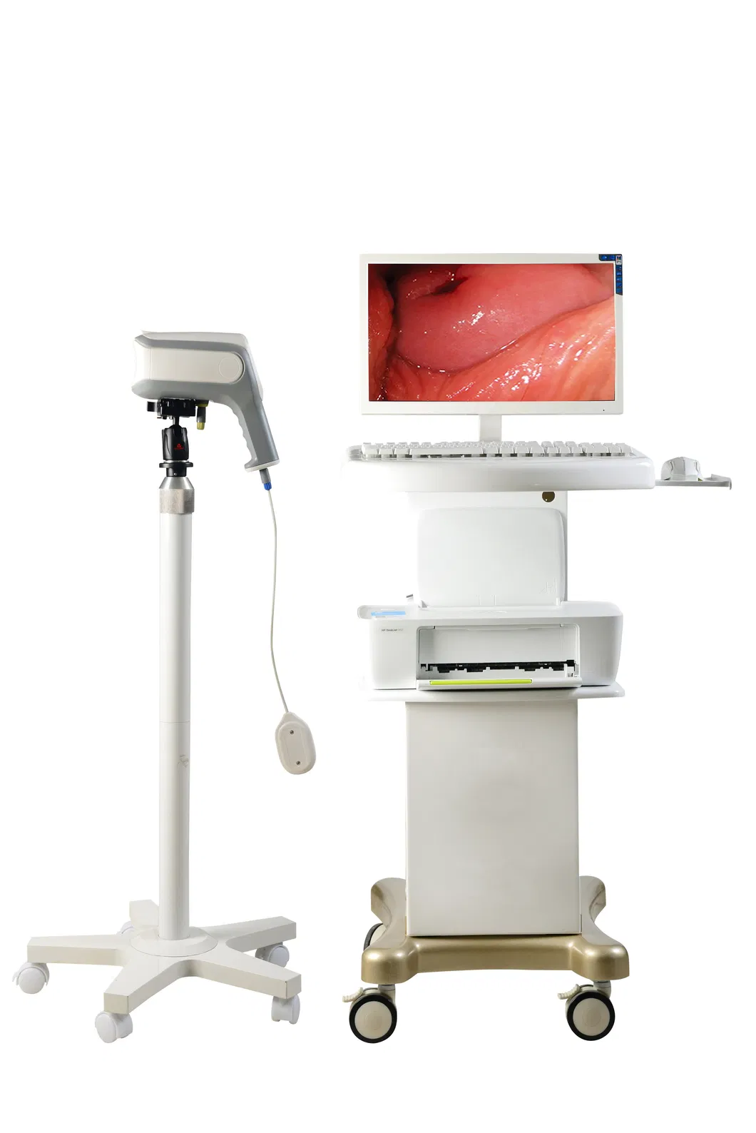 Standard ABS Trolley