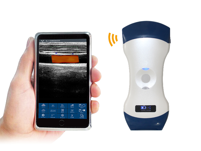 Ltub69 Portable Convex Linear Probe 2 in 1 Color Doppler Wireless Ultrasound Handheld Device