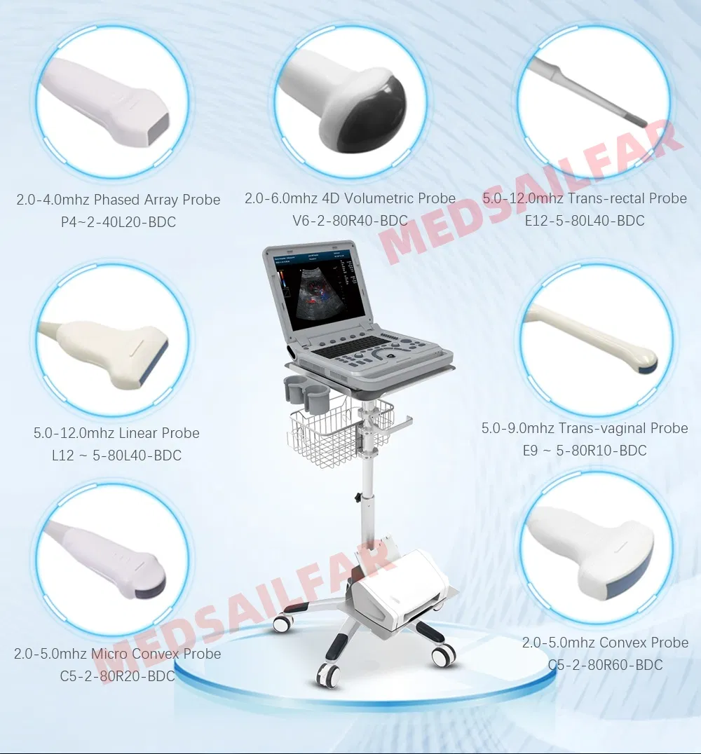 Ultrasound Equipment 5