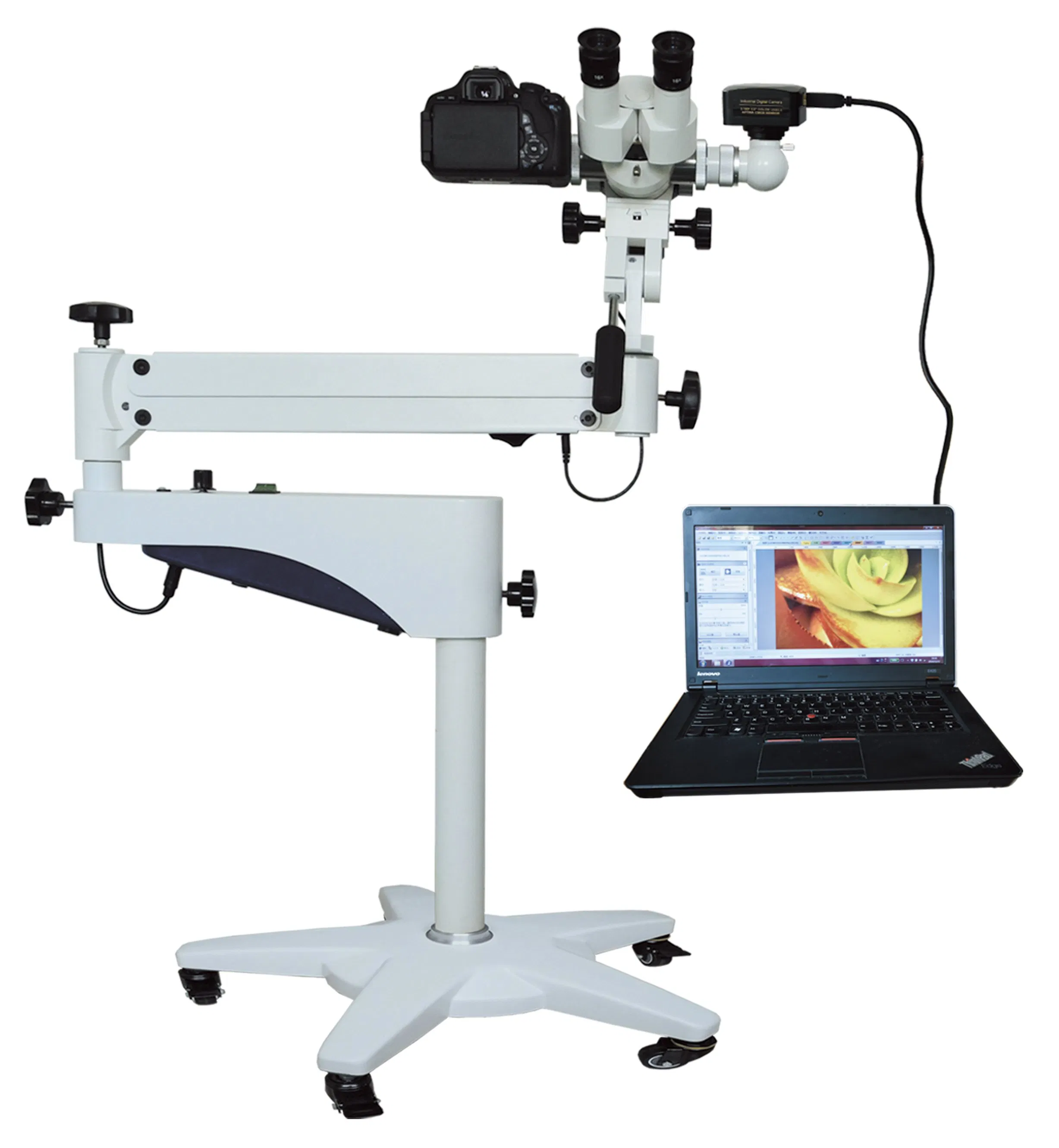 Advanced Digital Colposcope for Comprehensive Women's Health Care