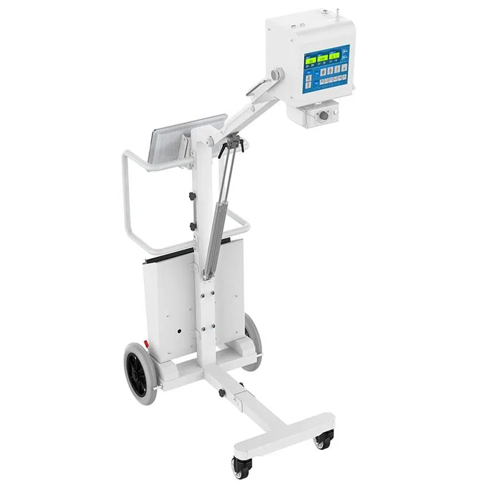 Human Portable Chest Xray Mobile Medical X-ray Equipments Dr Digital Portable X Ray Machine Price