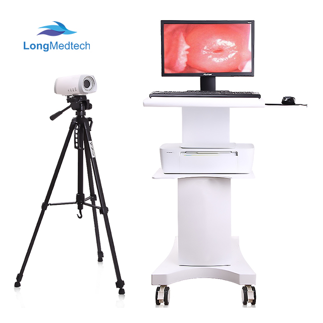Medical Trolley Electronic Mobile Digital Video Colposcope for Vagina Gynecology